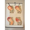 PLANCHE ANATOMIQUE "L'ACCOUCHEMENT" DEUTSCHES HYGIENE MUSEUM DRESDEN